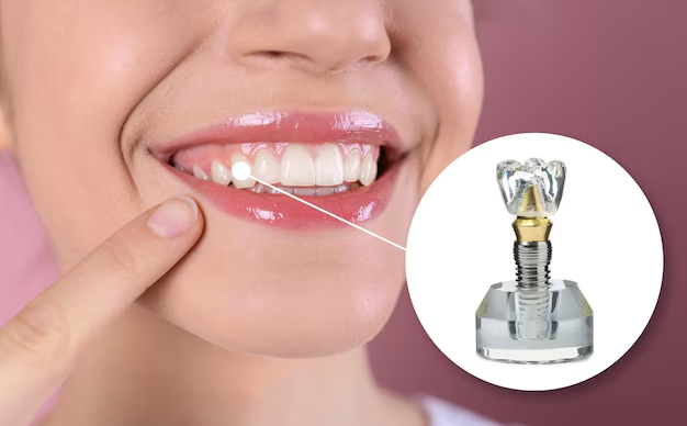 Prótese Dentária: Soluções Modernas para um Sorriso Perfeito